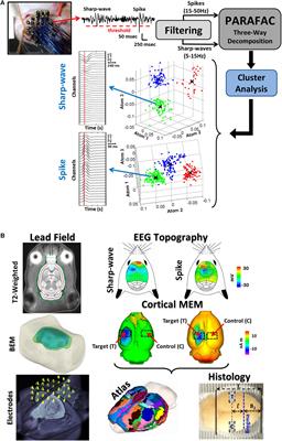 Histological Characterization of the Irritative Zones in Focal Cortical Dysplasia Using a Preclinical Rat Model